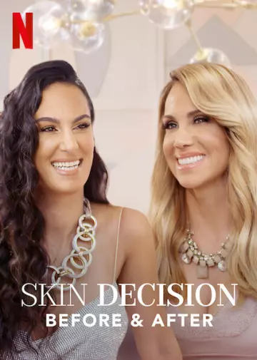 Skin Decision: Before and After - Saison 1 - VF